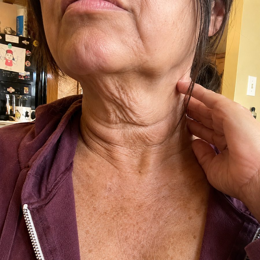 Cuello antes