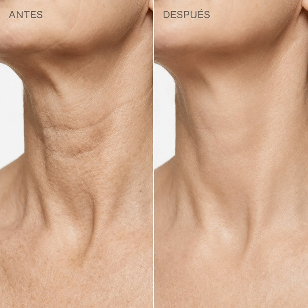 El cuello de cerca, antes y después